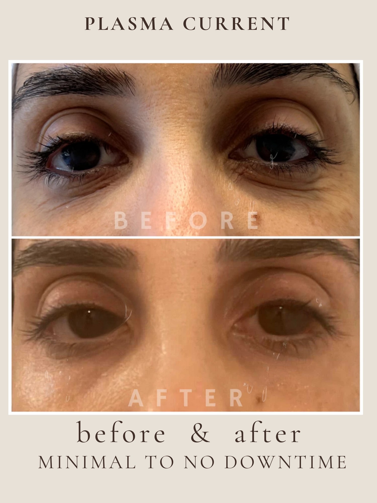 Plasma Current before and after