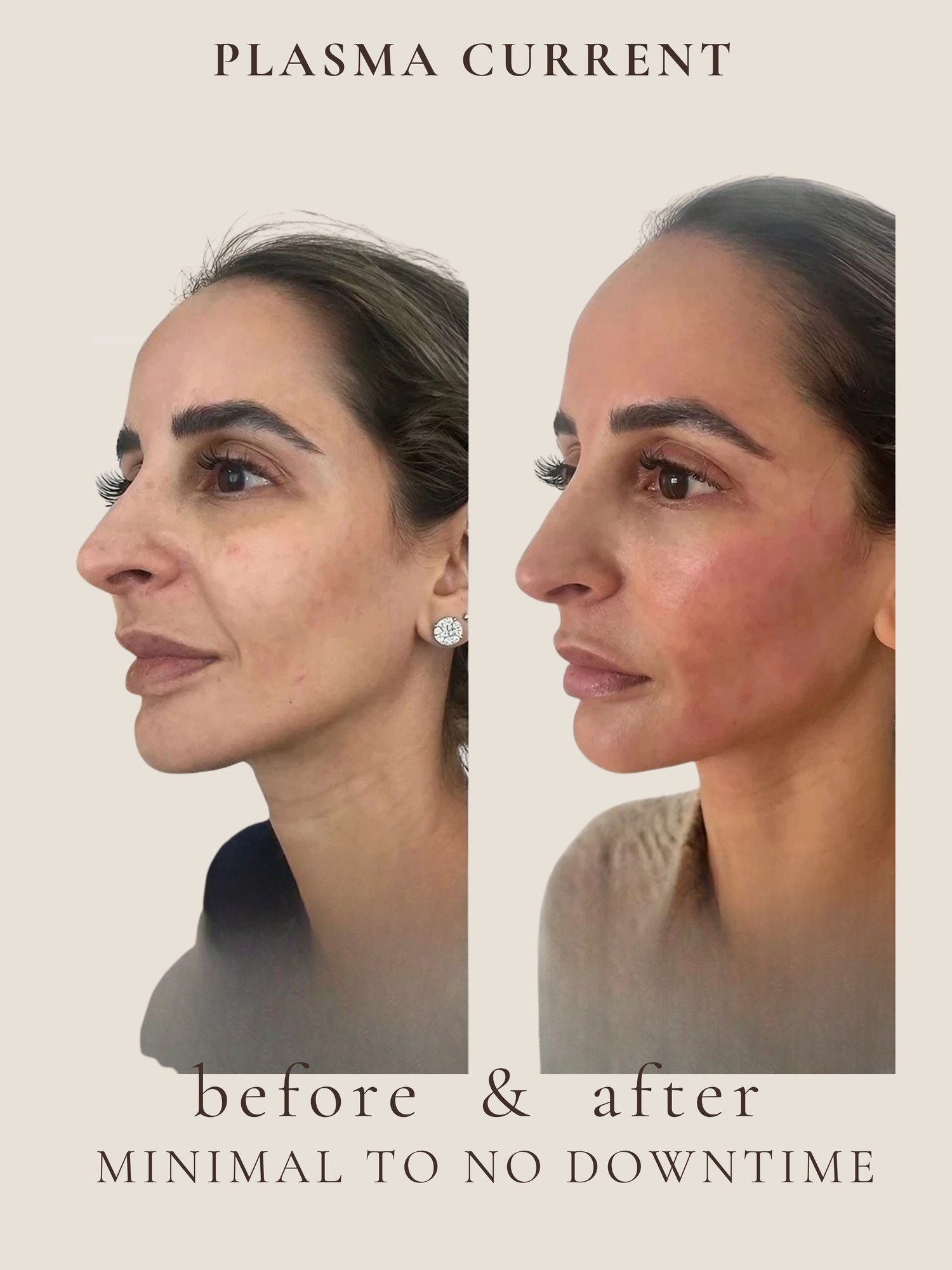 Plasma Current before and after