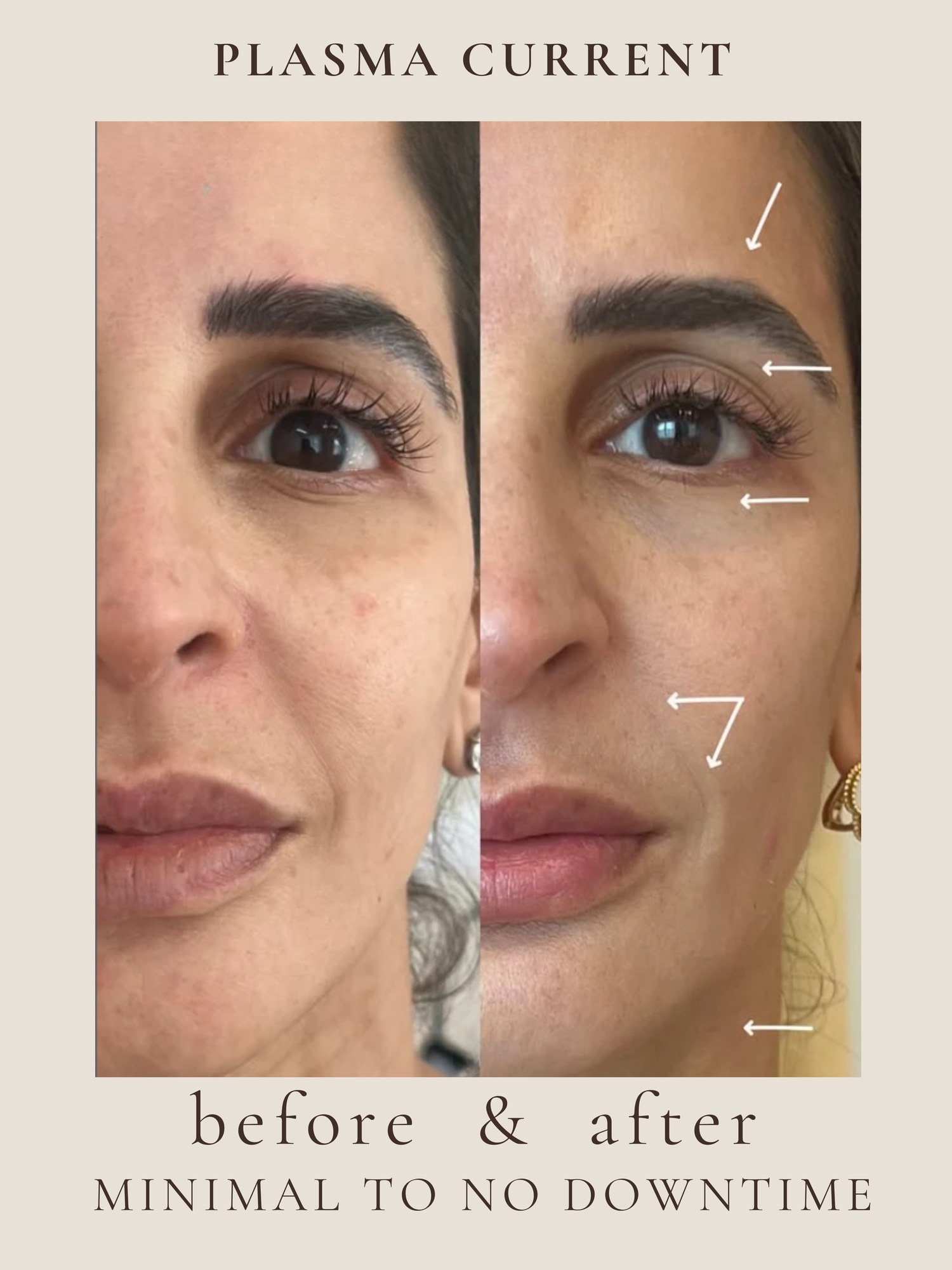 Plasma Current before and after