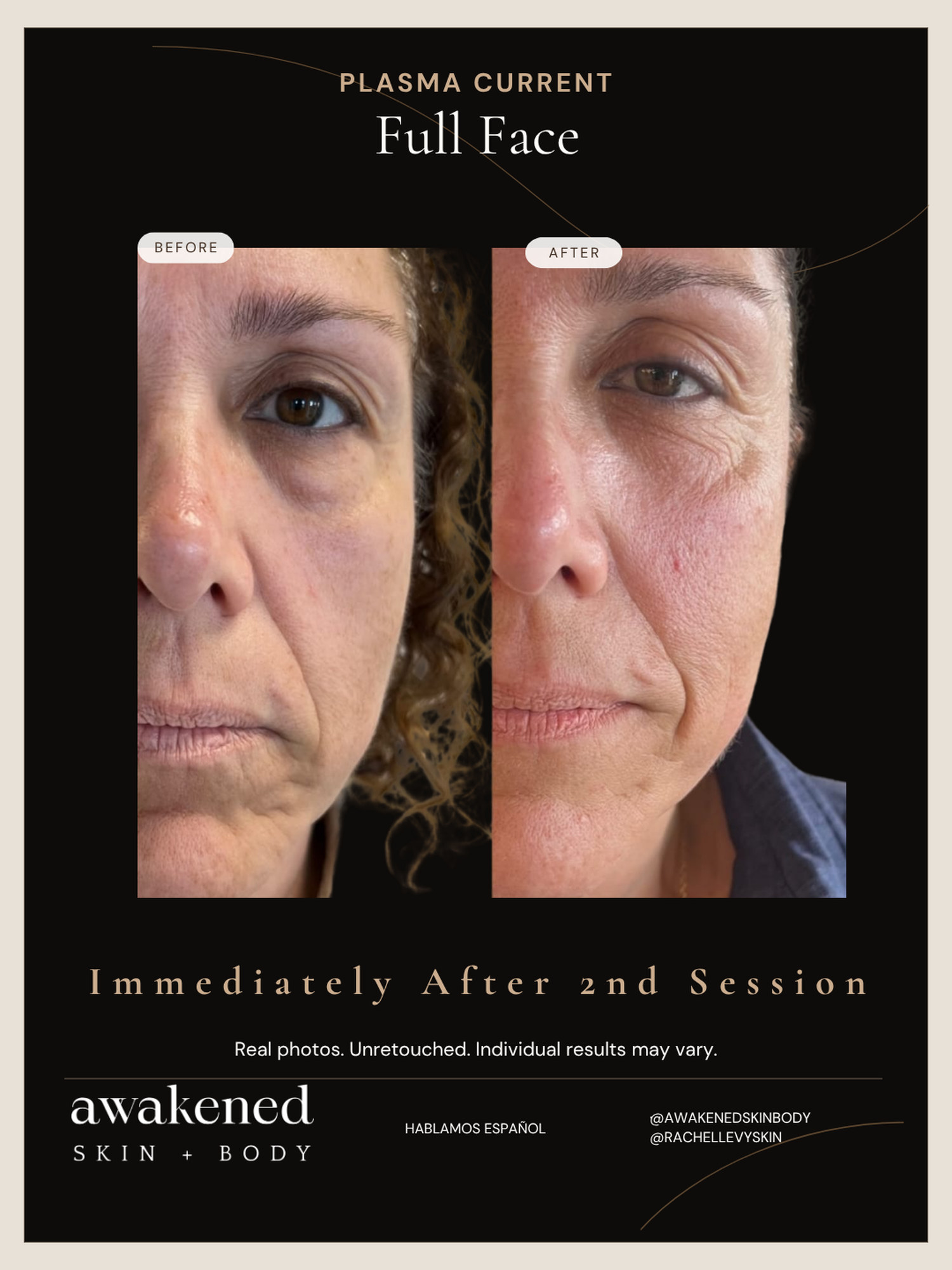 Full face before and after, Plasma Current