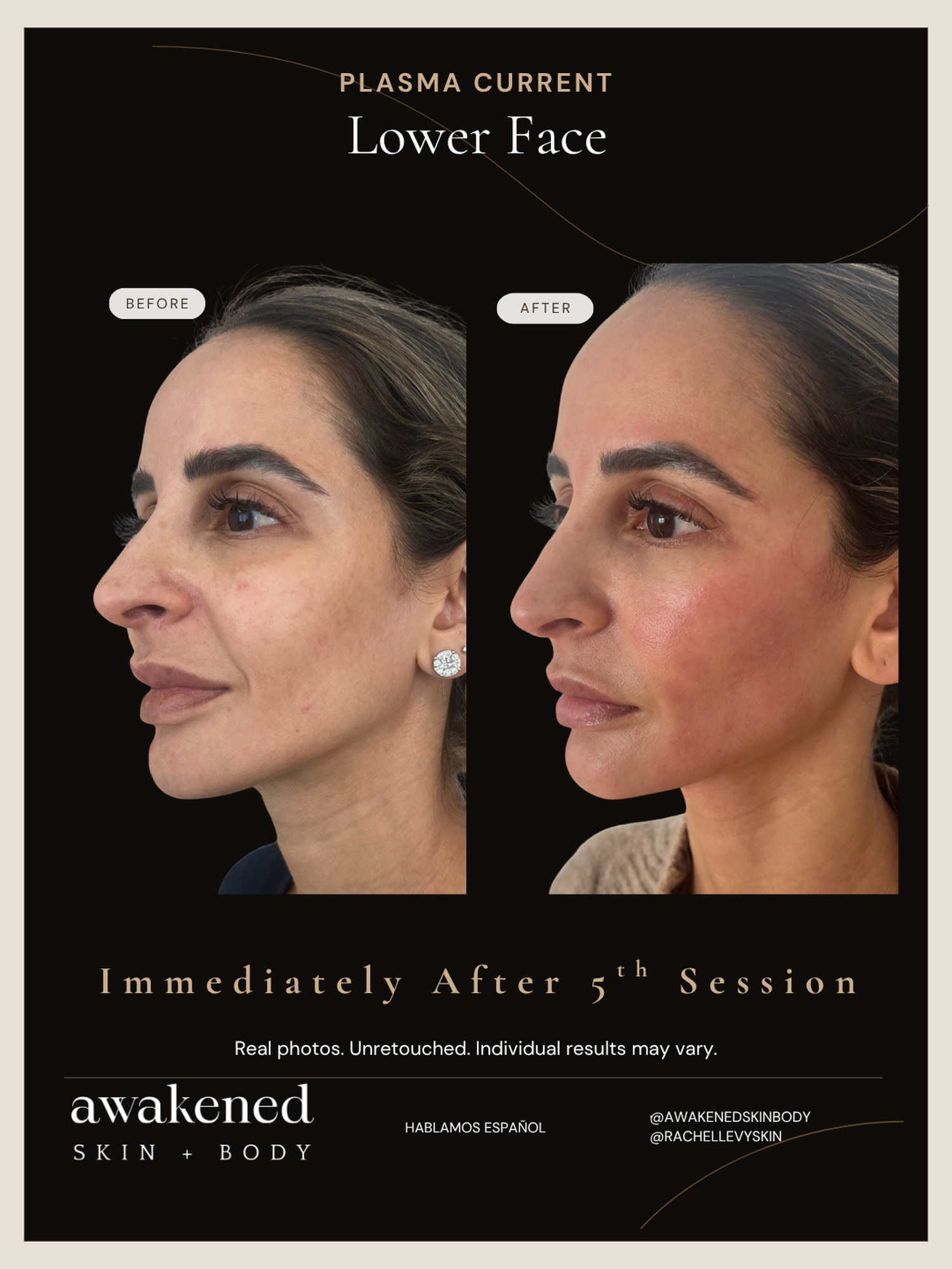 Lower face before and after, Plasma Current