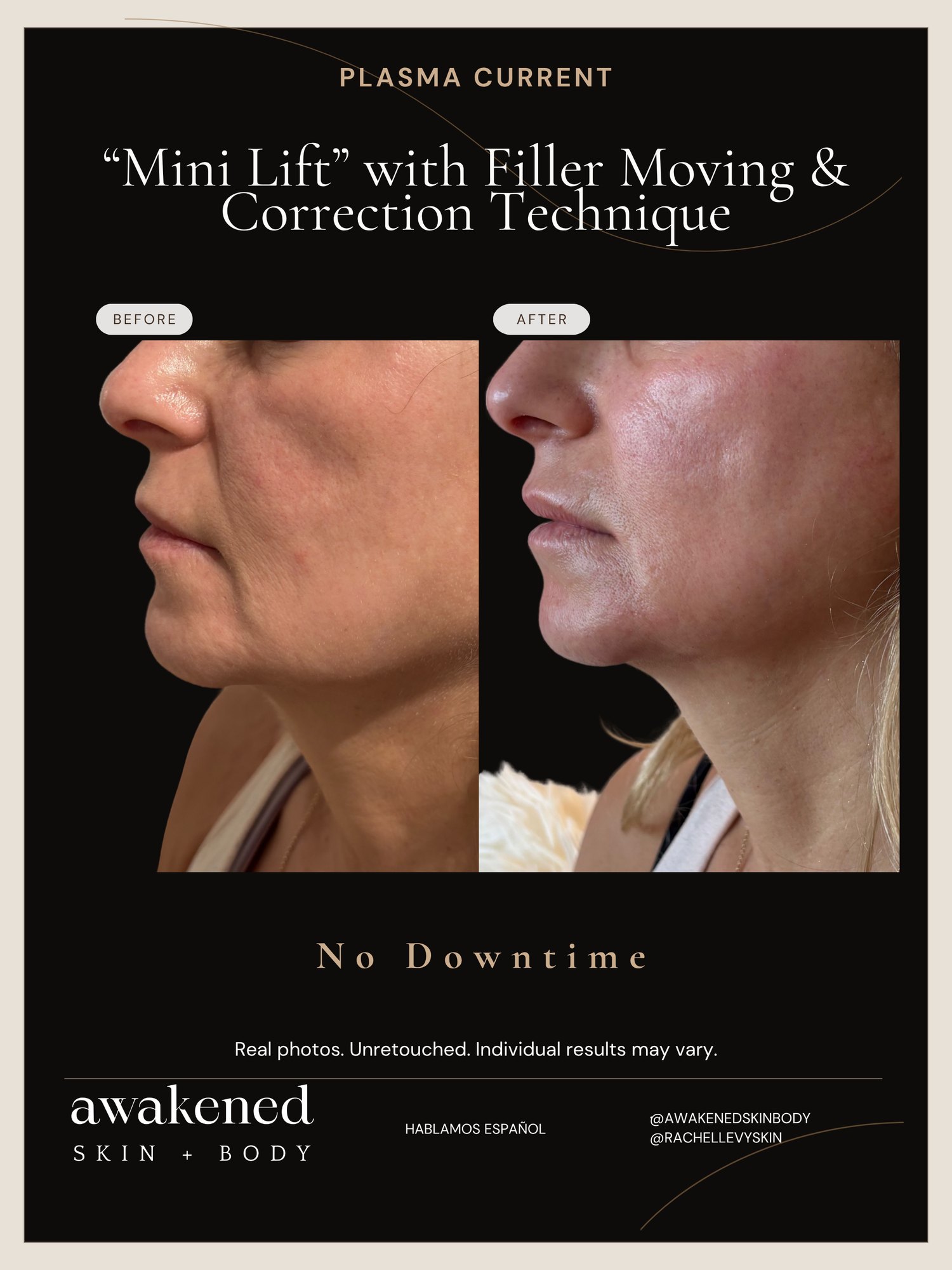 Mini Lift before and after, Plasma Current