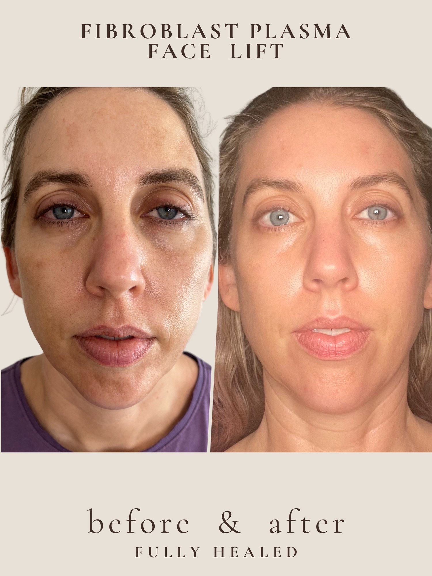 Treatment result