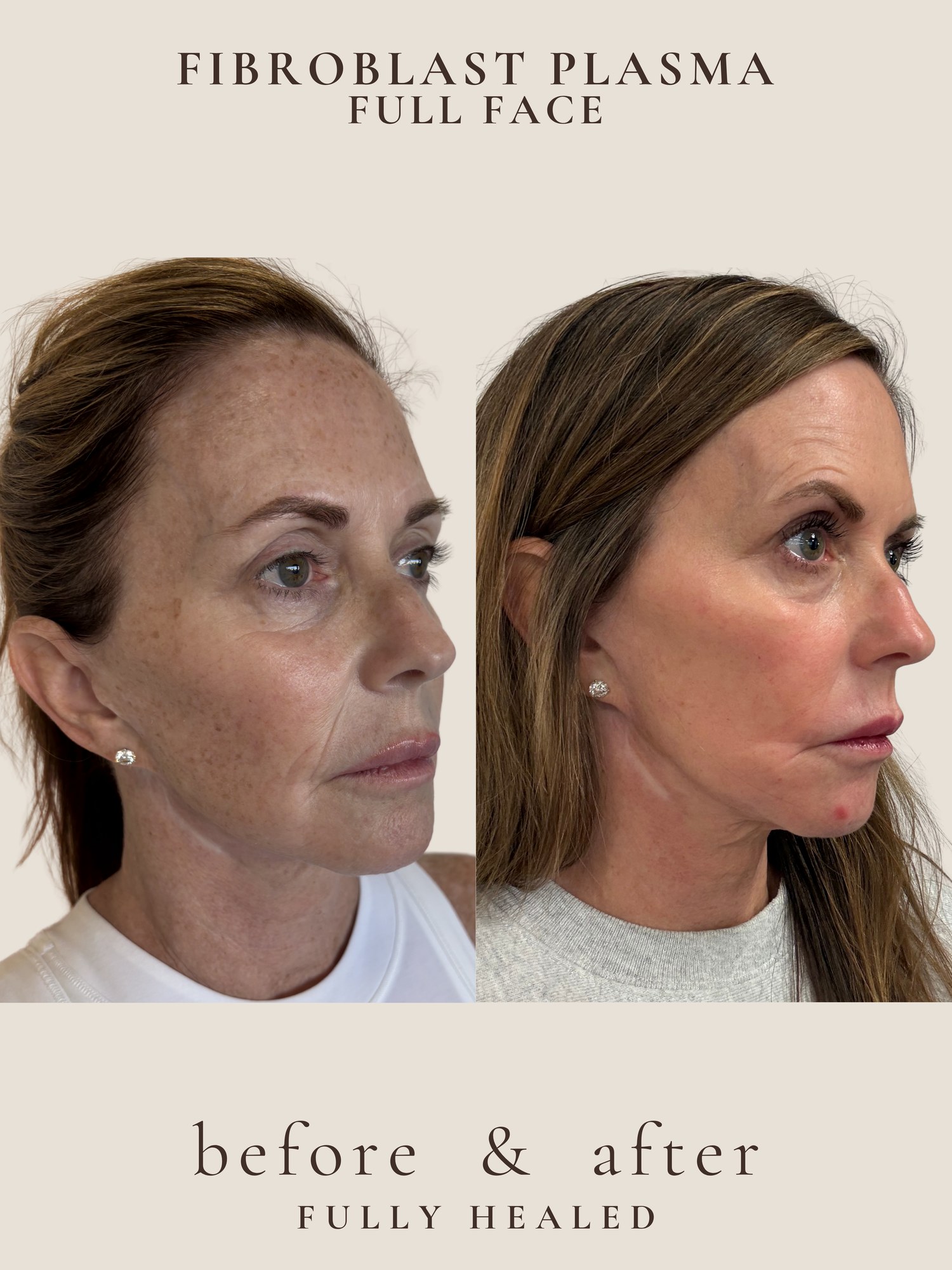 Face restoration before and after