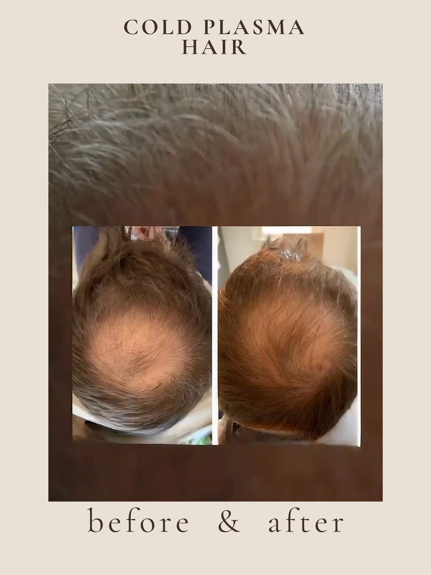 Hair regrowth before and after