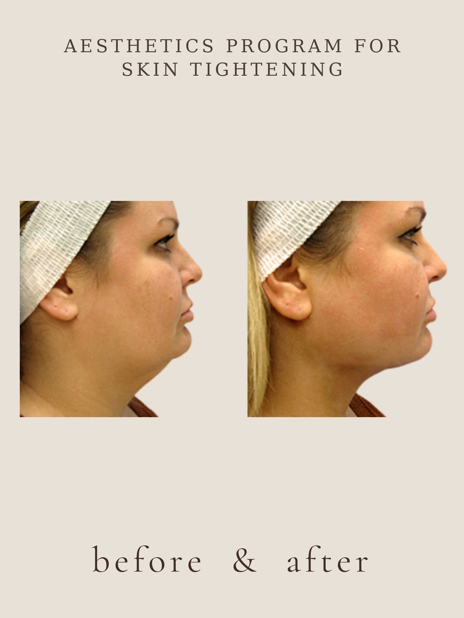 Body Contouring — Invisa-RED® Aesthetics