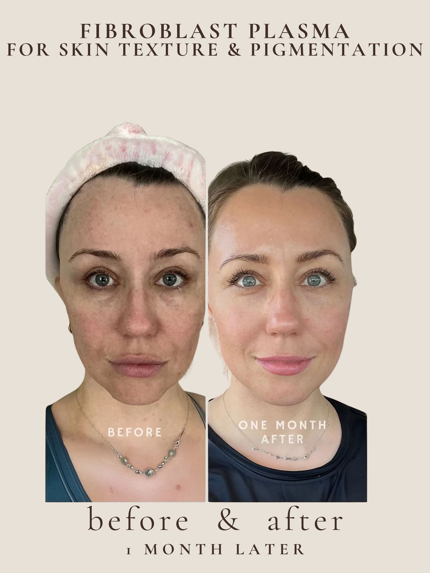 Skin texture and pigmentation before and after