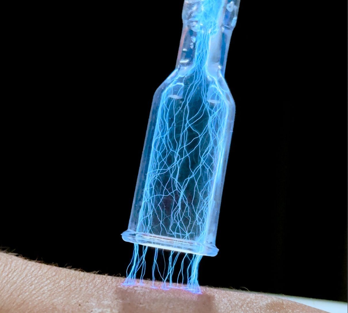 Fusion Plasma Pro device delivering cold plasma treatment