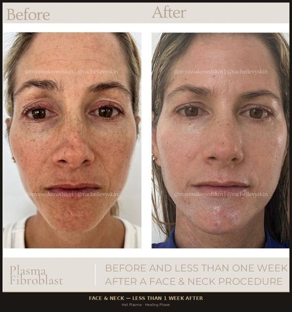 Face & Neck