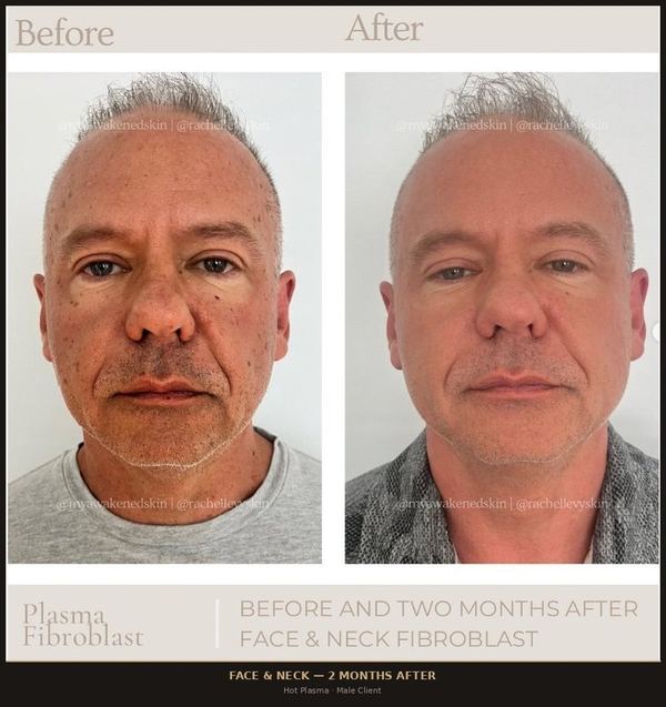 Face & Neck