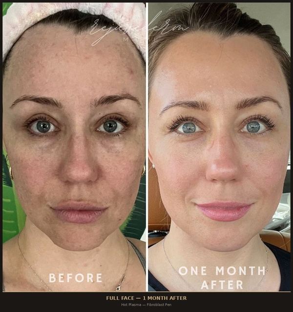 Full Face