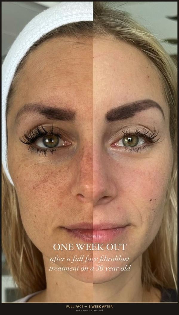Full Face