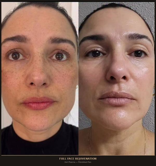 Full Face