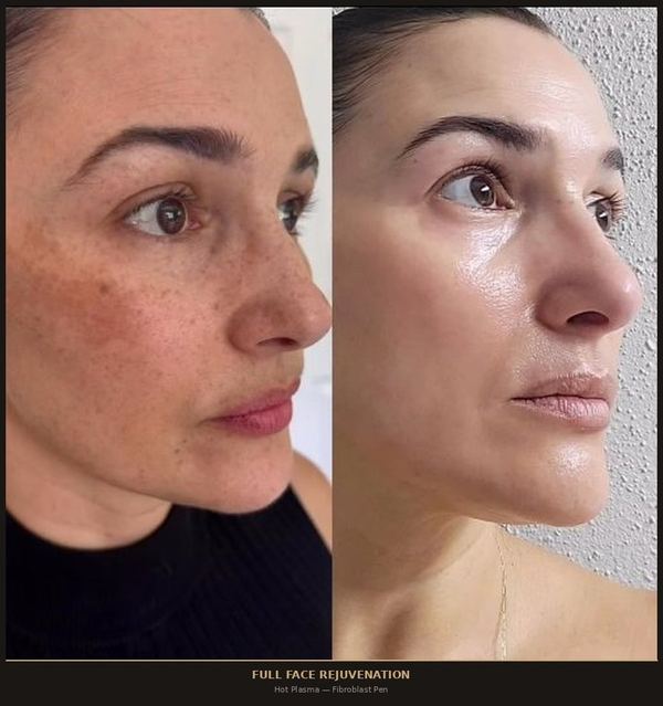 Full Face Profile