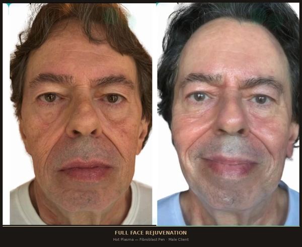 Full Face