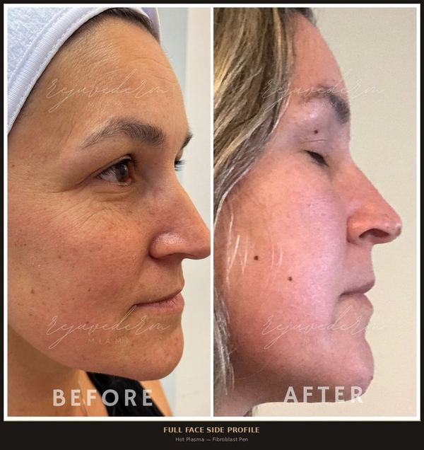Full Face Side Profile